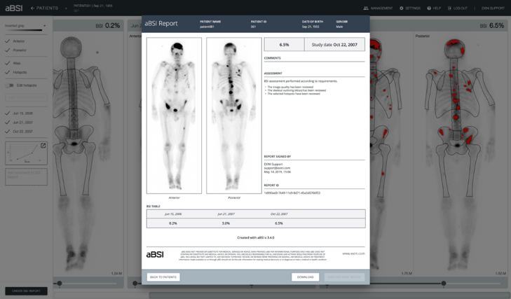 PRESS RELEASE for Exini Diagnostics